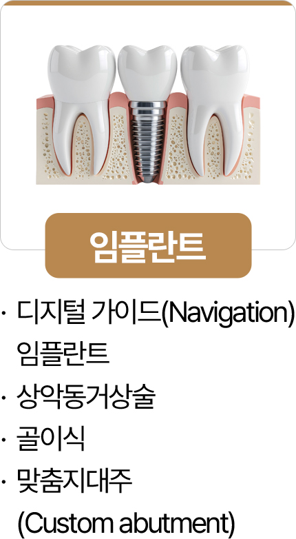 365서울진심치과 임플란트 진료