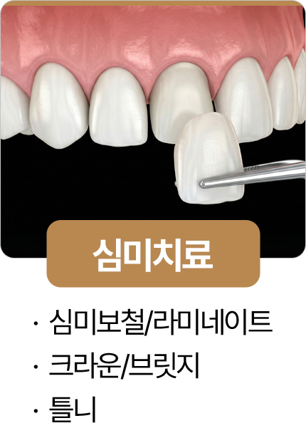 365서울진심치과 심미치료