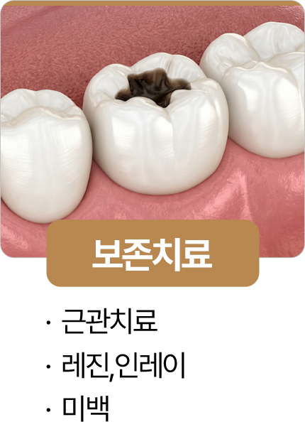 365서울진심치과 보존치료
