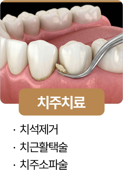 365서울진심치과 치주치료
