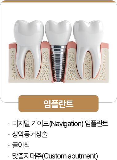 365서울진심치과 임플란트 진료